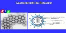 630_gastroenteriti-da-rotavirus