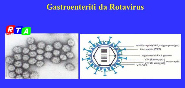 630_gastroenteriti-da-rotavirus