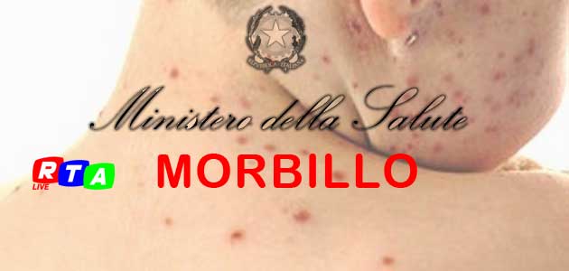 630-sanità-morbillo-rtalive-vaccino