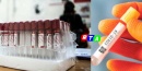 test-covid-19-laboratori-privati-rtalive-campania