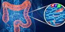 intestino-malattie-microbiota-RTAlive